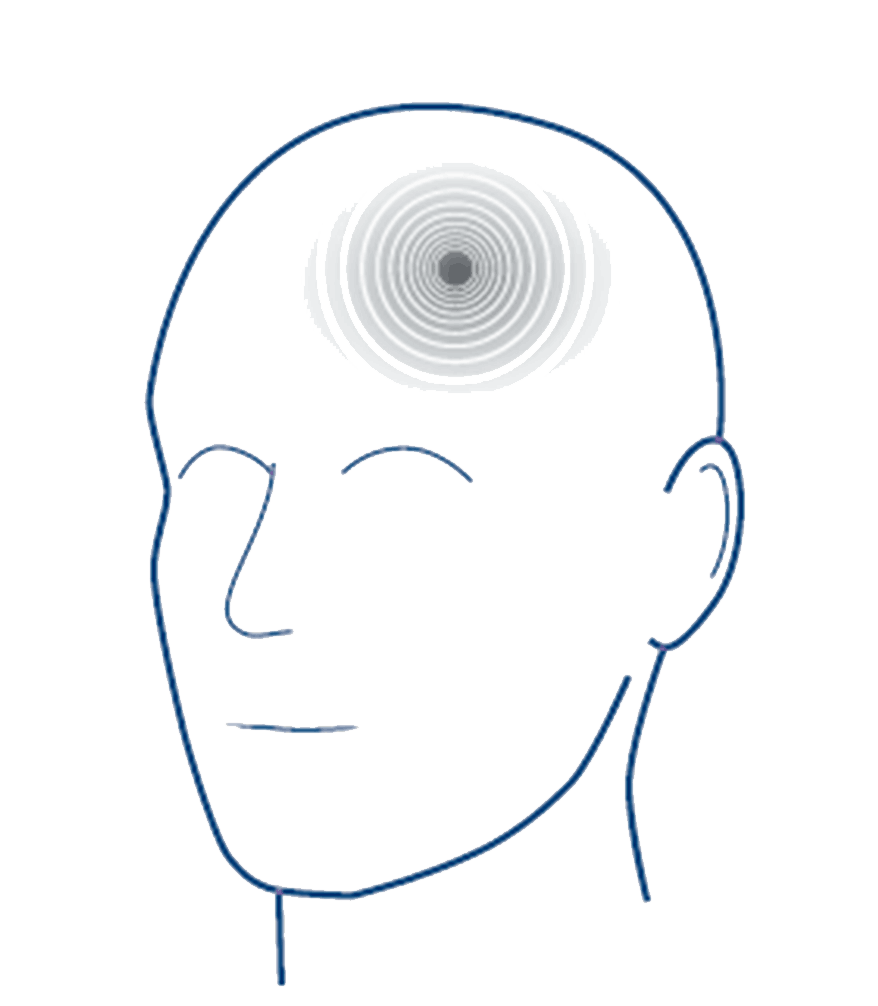 What Causes Tinnitus Ringing In The Ears Beltone